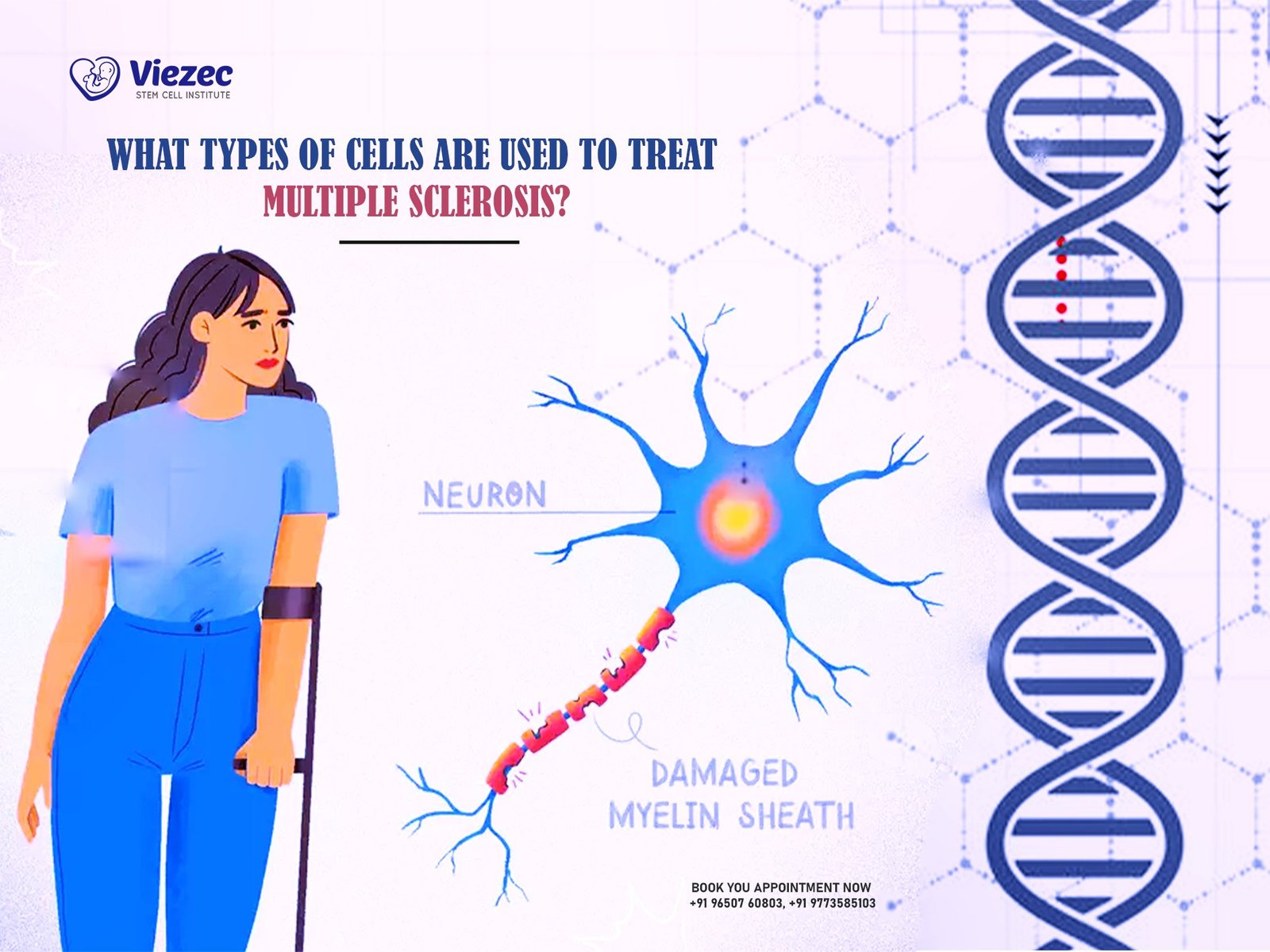 What Types of Cells are Used to Treat Multiple Sclerosis?