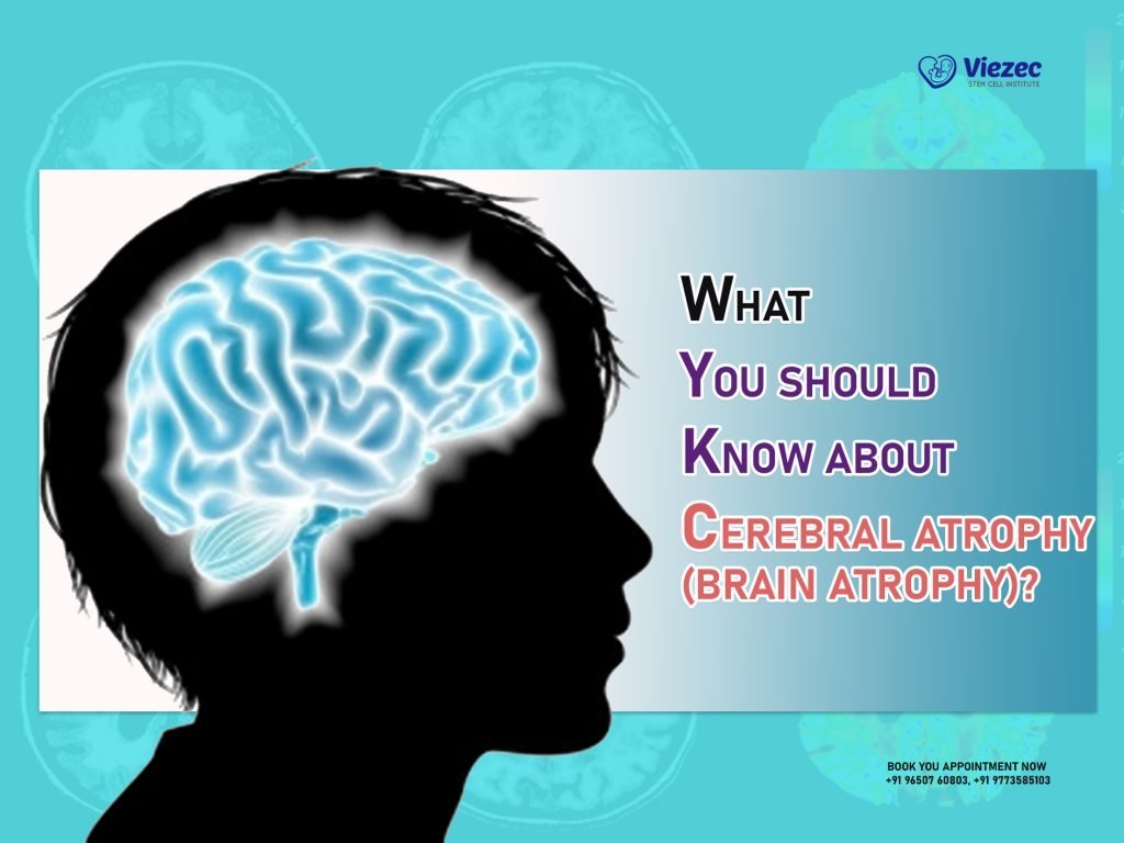 What You Should Know About Cerebral Atrophy (Brain Atrophy)