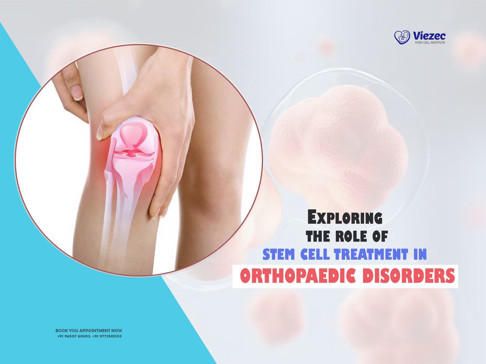 Exploring the Role of Stem Cell Treatment in Orthopaedic Disorders
