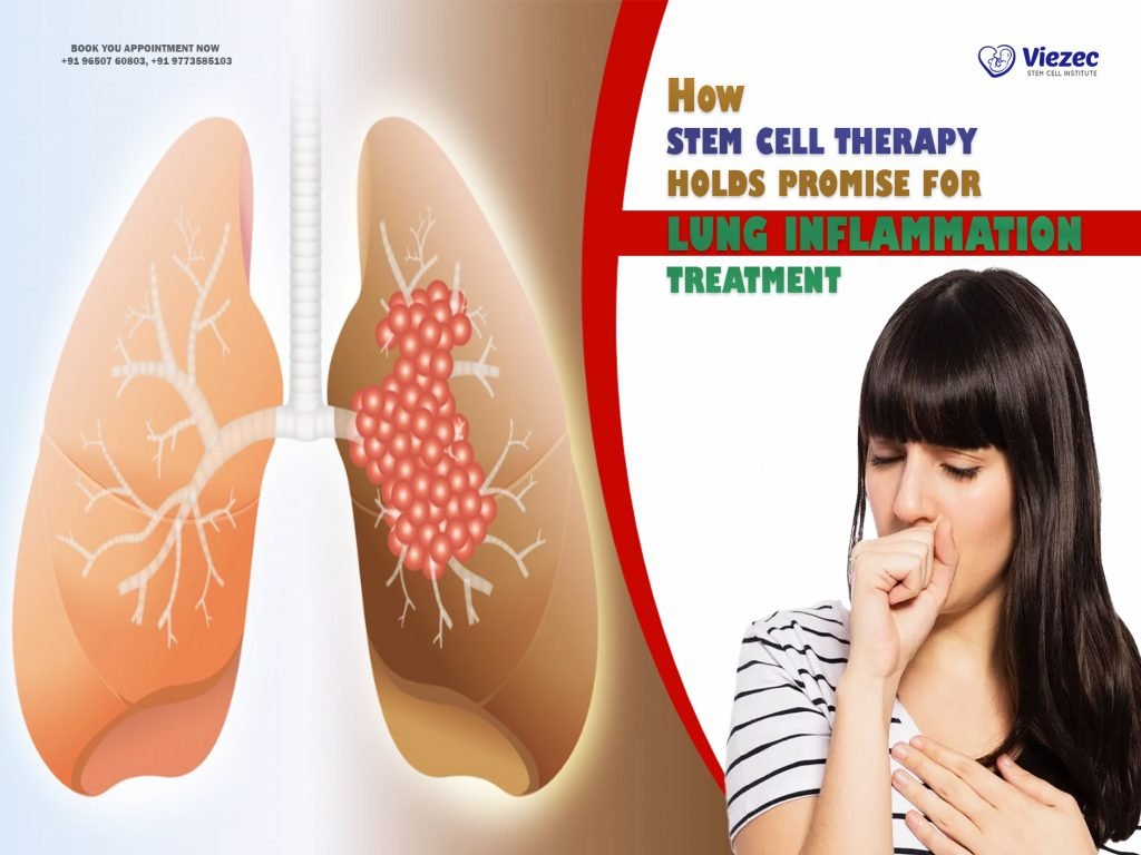 How Stem Cell Therapy Holds Promise for Lung Inflammation Treatment