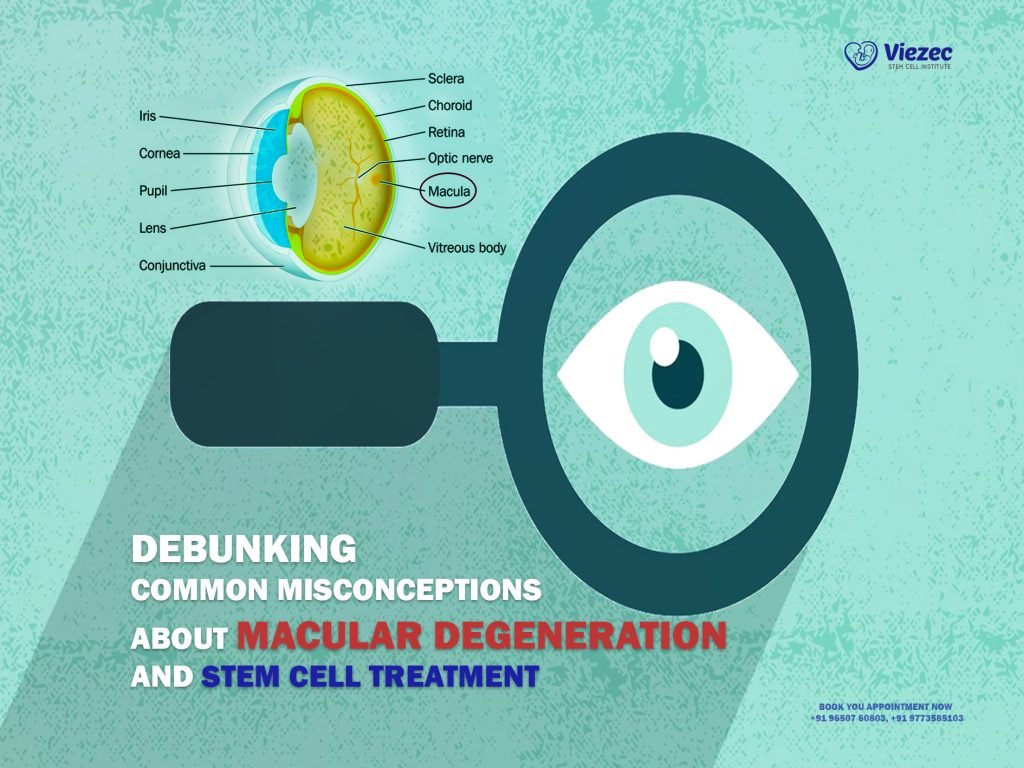 Debunking Common Misconceptions About Macular Degeneration and Stem Cell Treatment