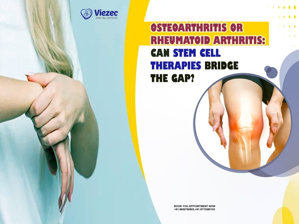 Osteoarthritis or Rheumatoid Arthritis: Can Stem Cell Therapies Bridge the Gap?