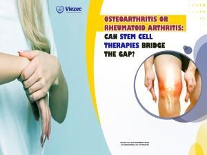 Osteoarthritis or Rheumatoid Arthritis: Can Stem Cell Therapies Bridge the Gap?