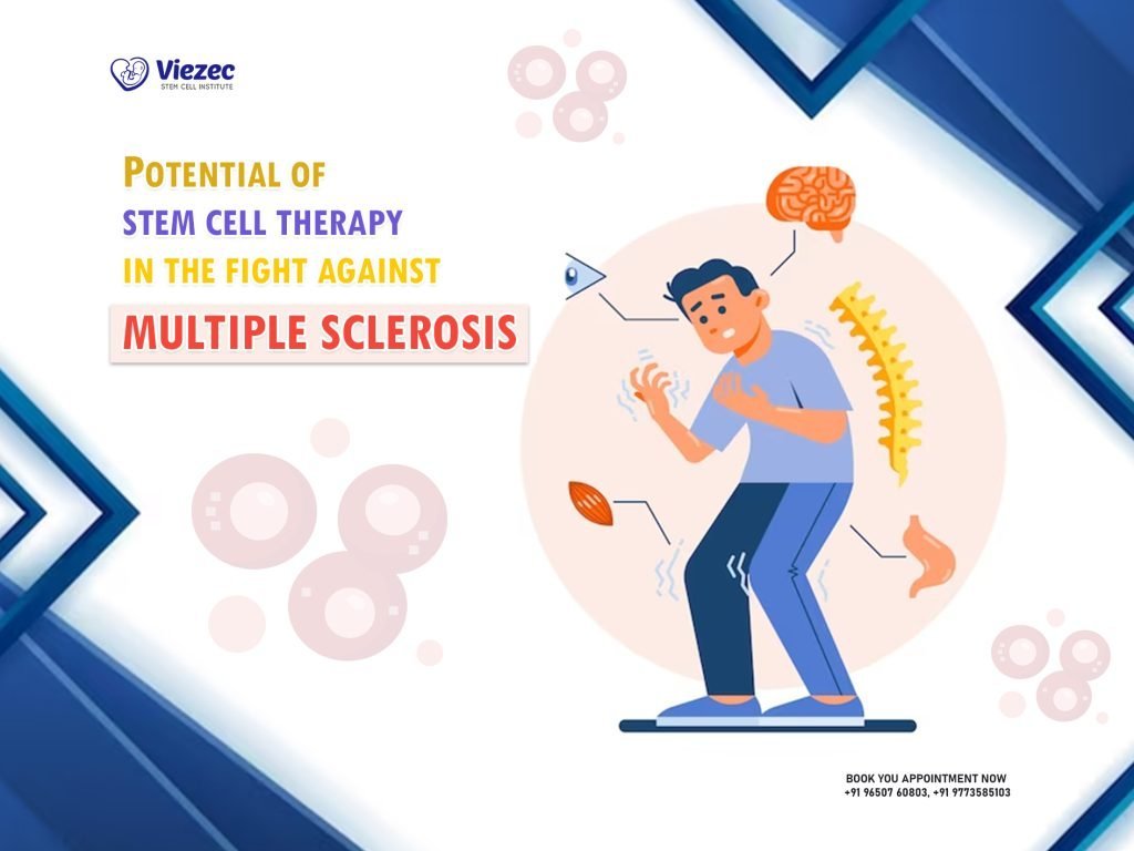 Potential of Stem Cell Therapy in the Fight Against Multiple Sclerosis