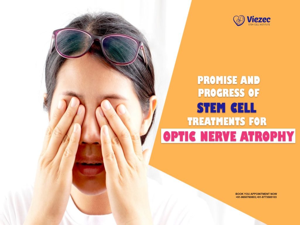 Promise and Progress of Stem Cell Treatments for Optic Nerve Atrophy