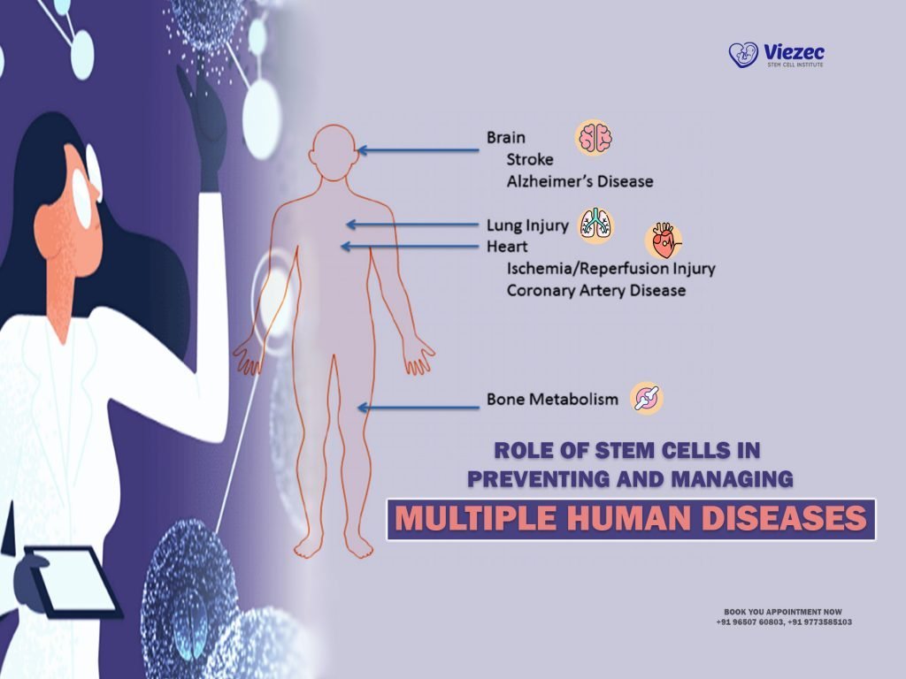 Role of Stem Cells in Preventing and Managing Multiple Human Diseases