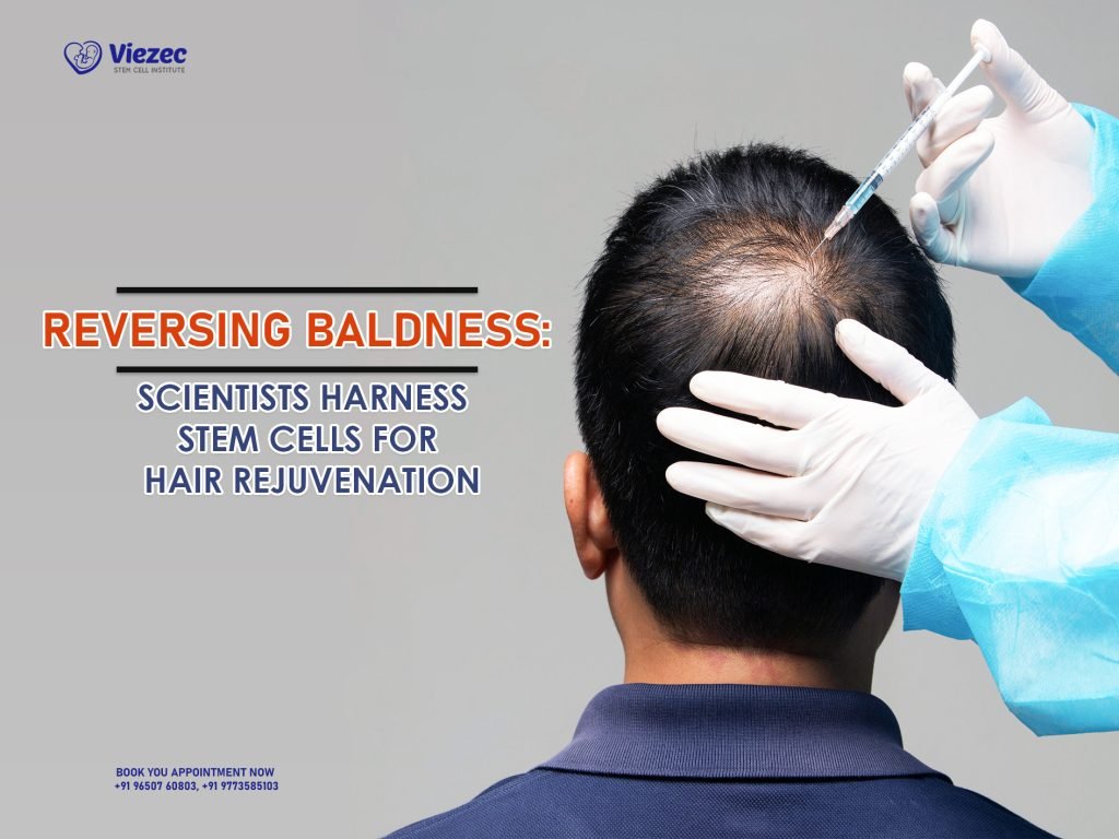 Reversing Baldness: Scientists Harness Stem Cells for Hair Rejuvenation