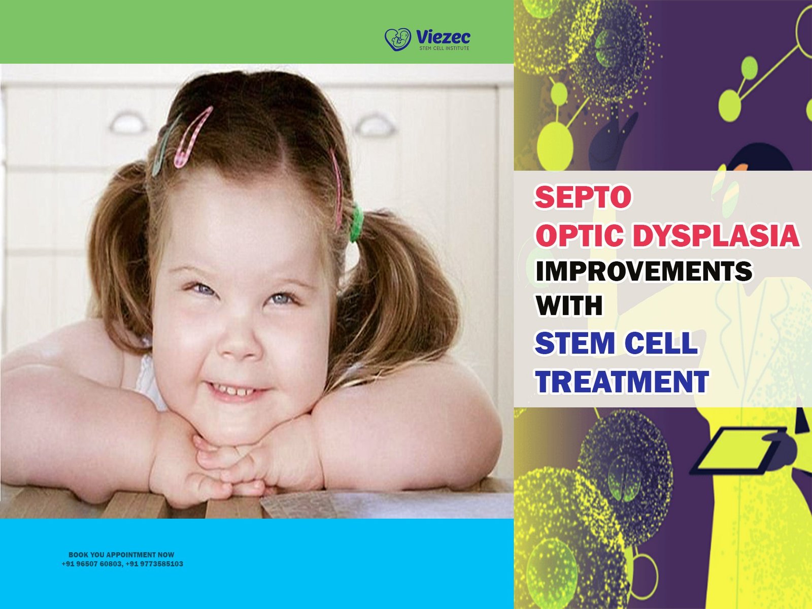 Septo Optic Dysplasia Improvements with Stem Cell Treatment