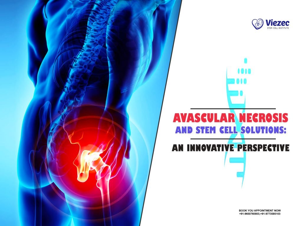 Avascular Necrosis and Stem Cell Solutions: An Innovative Perspective