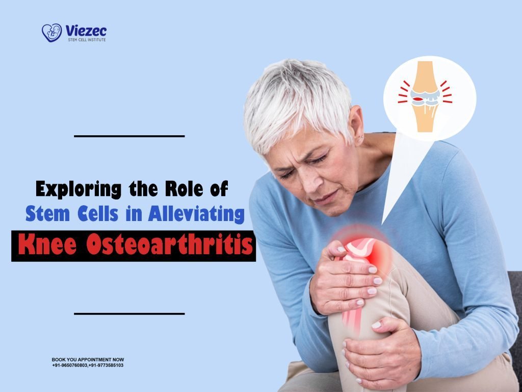 Exploring the Role of Stem Cells in Alleviating Knee Osteoarthritis