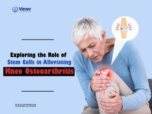 Exploring the Role of Stem Cells in Alleviating Knee Osteoarthritis