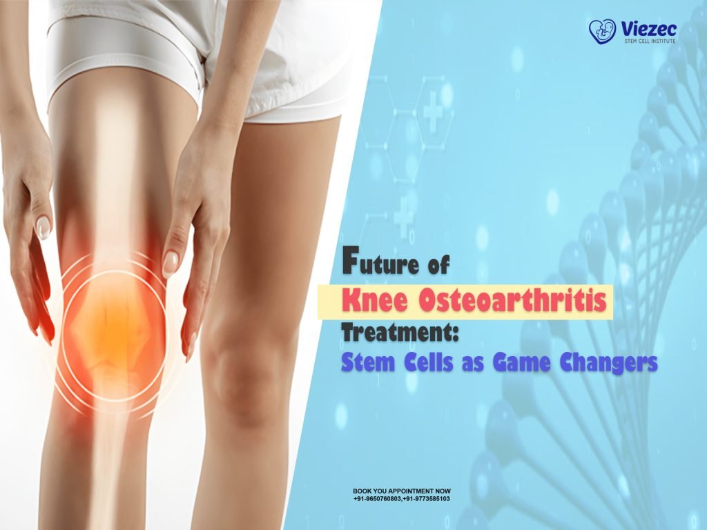 Future of Knee Osteoarthritis Treatment: Stem Cells as Game Changers