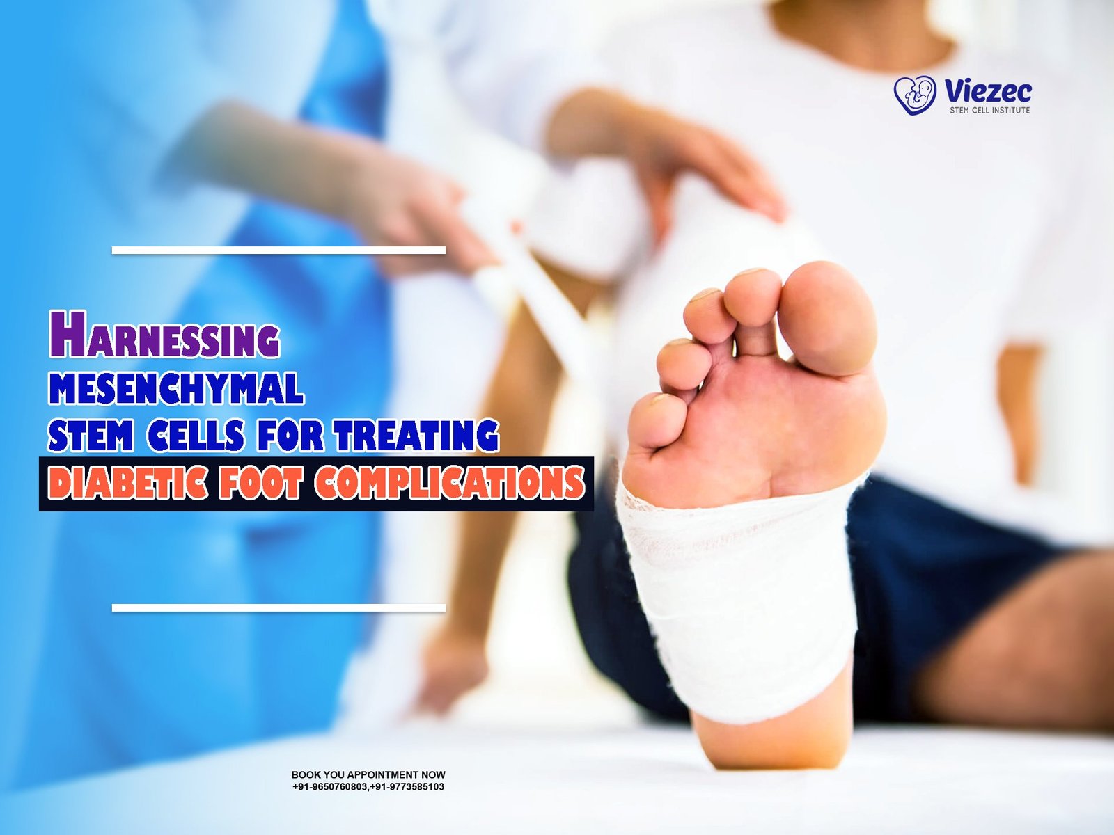 Harnessing Mesenchymal Stem Cells for Treating Diabetic Foot Complications