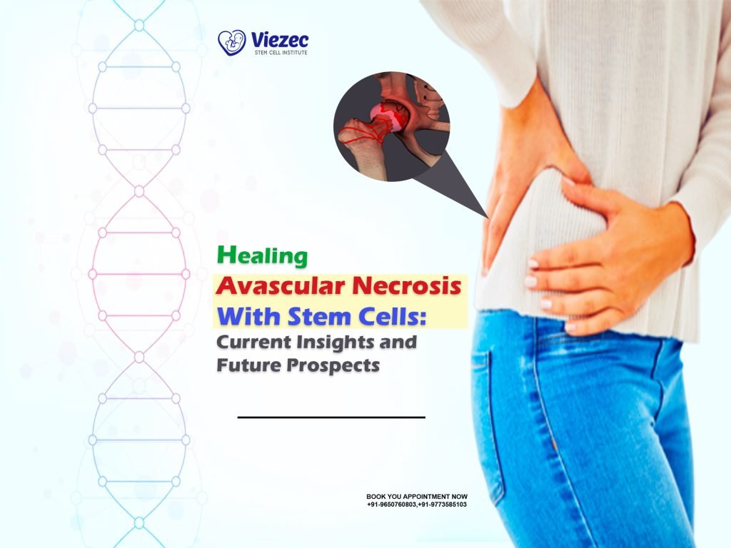 Healing Avascular Necrosis with Stem Cells: Current Insights and Future Prospects
