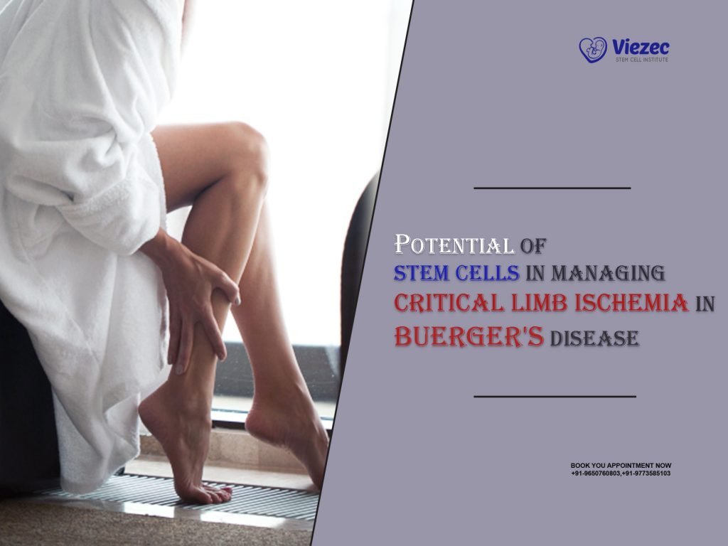 Managing Critical Limb Ischemia