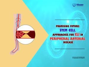 CLI in Peripheral Arterial Disease