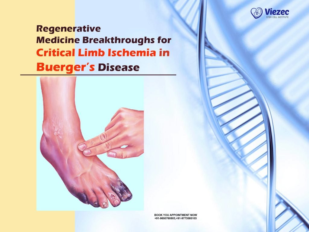 Regenerative Medicine Breakthroughs for Critical Limb Ischemia in Buerger's Disease