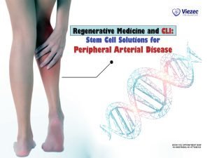 Regenerative Medicine and CLI: Stem Cell Solutions for Peripheral Arterial Disease