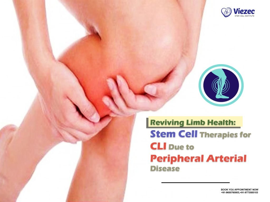 Reviving Limb Health: Stem Cell Therapies for CLI Due to Peripheral Arterial Disease