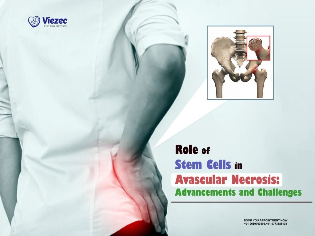 Role of Stem Cells in Avascular Necrosis