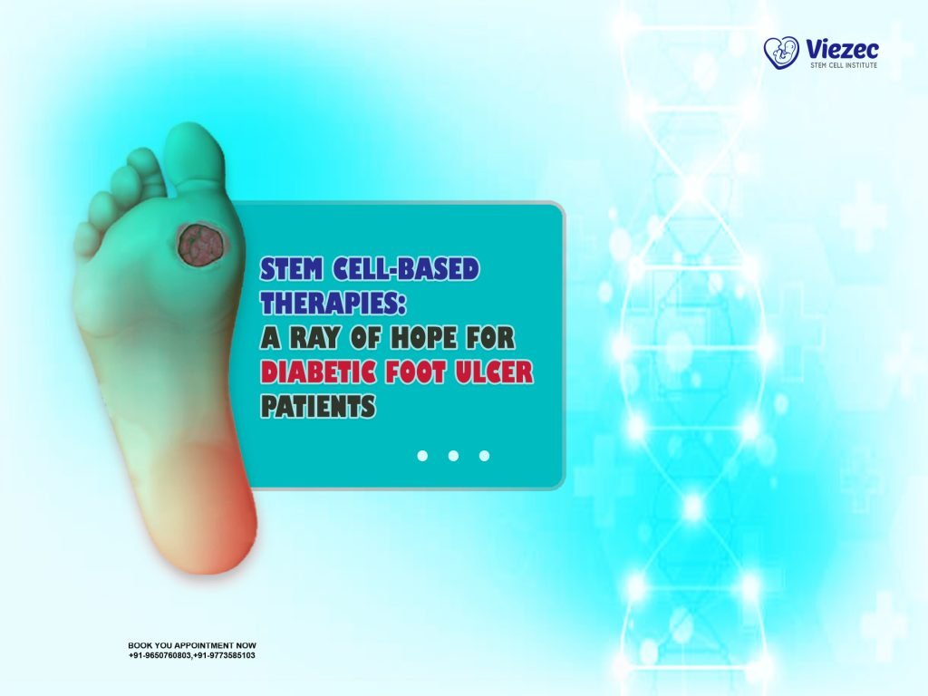Stem CellBased Therapies Hope for Diabetic Foot Ulcer Patients