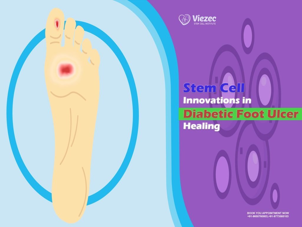 Stem Cell Innovations in Diabetic Foot Ulcer Healing