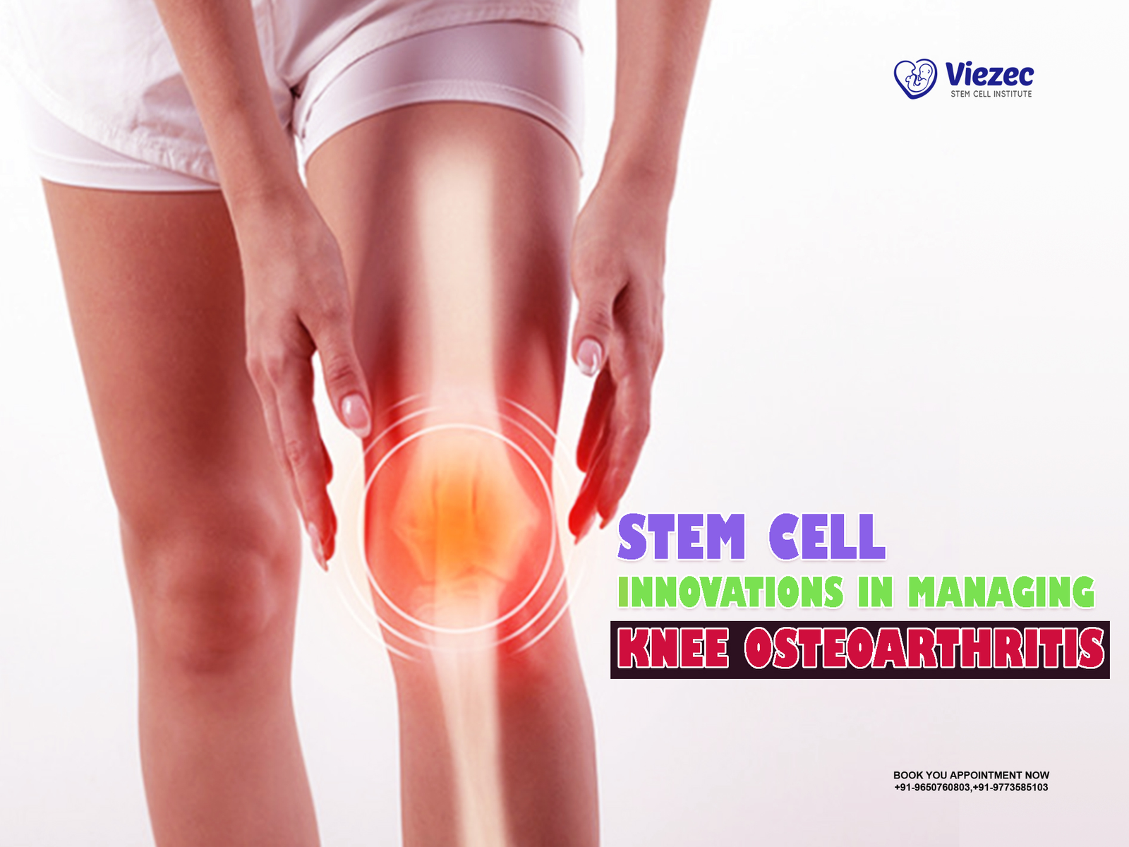 Stem Cell Innovations in Managing Knee Osteoarthritis