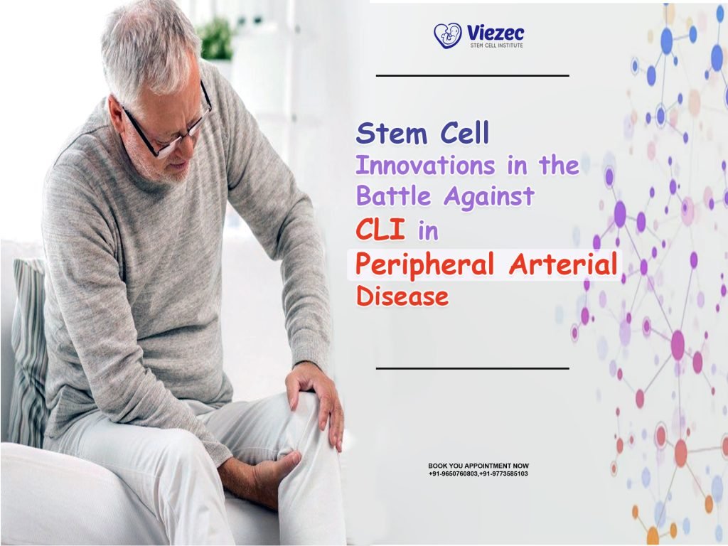 Stem Cell Innovations in the Battle Against CLI in Peripheral Arterial Disease