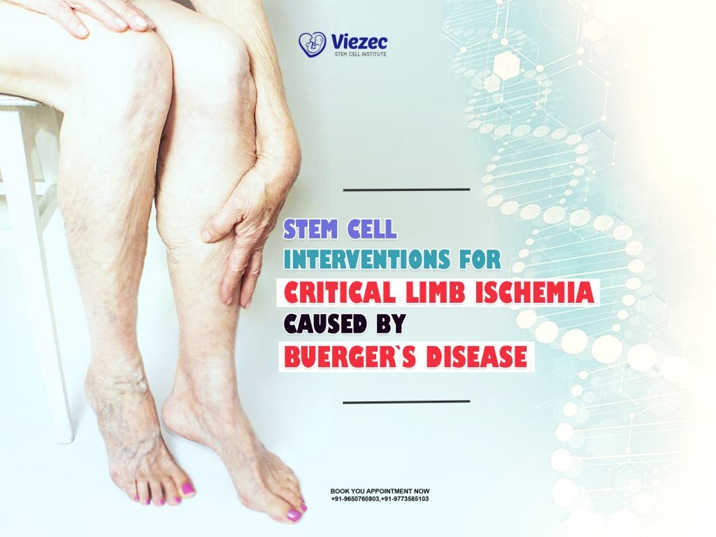 Stem Cell Interventions for Critical Limb Ischemia Caused by Buerger's Disease