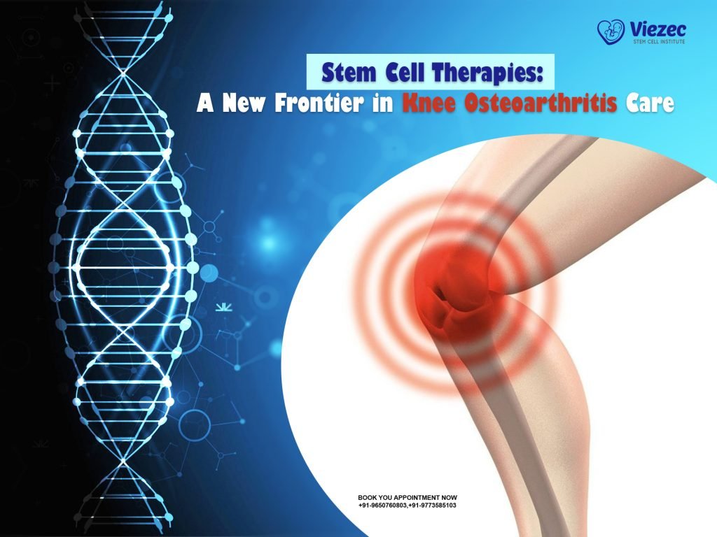 Stem Cell Therapies: A New Frontier in Knee Osteoarthritis Care