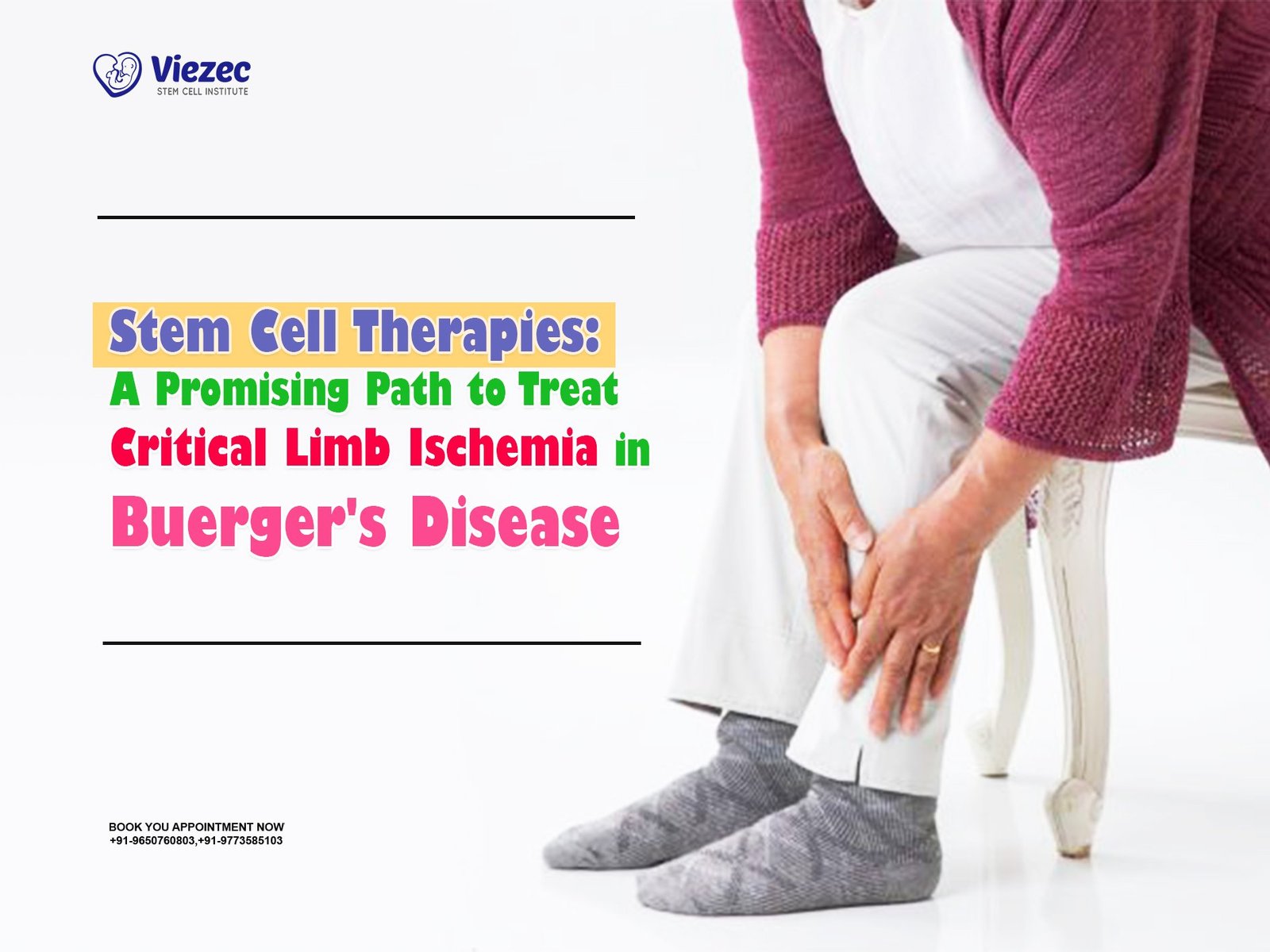 Stem Cell Therapies: A Promising Path to Treat Critical Limb Ischemia in Buerger's Disease