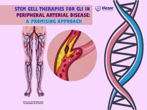 Peripheral Arterial Disease