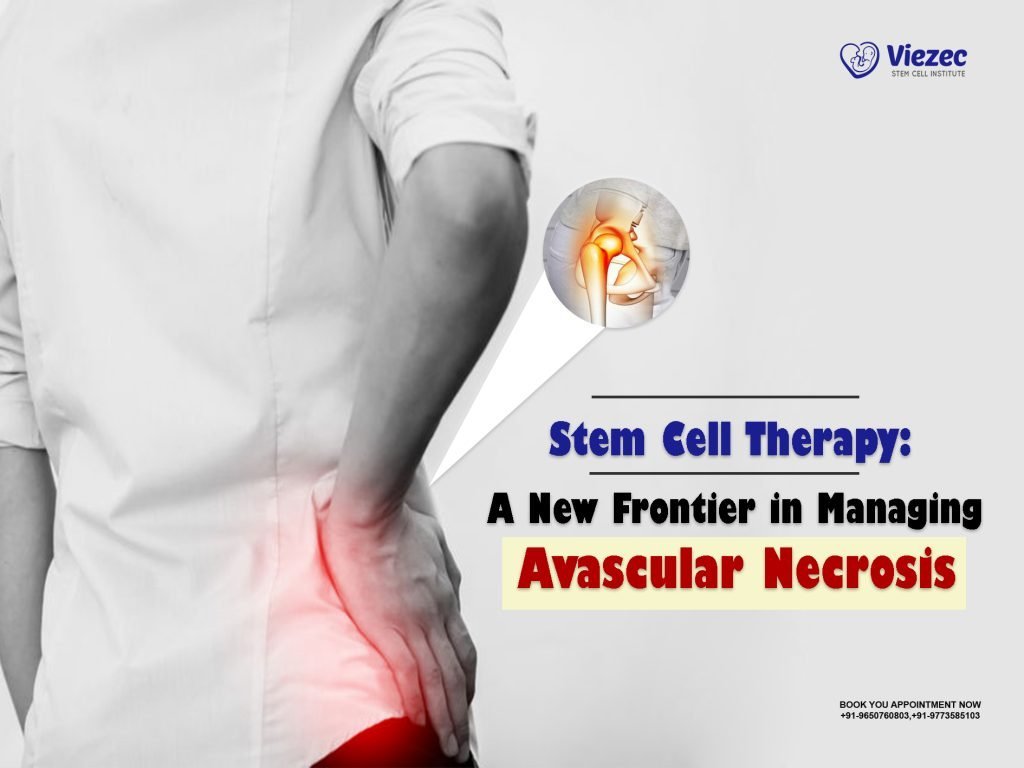 Stem Cell Therapy: A New Frontier in Managing Avascular Necrosis