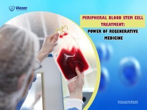 Peripheral Blood Stem Cell