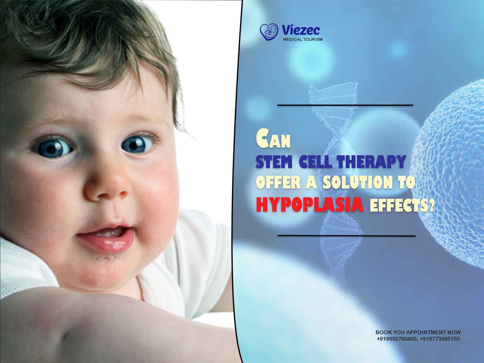 Stem Cell Therapy
