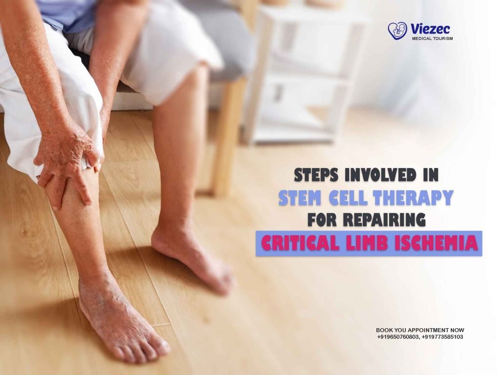 Steps Involved in Stem Cell Therapy for Repairing Critical Limb Ischemia