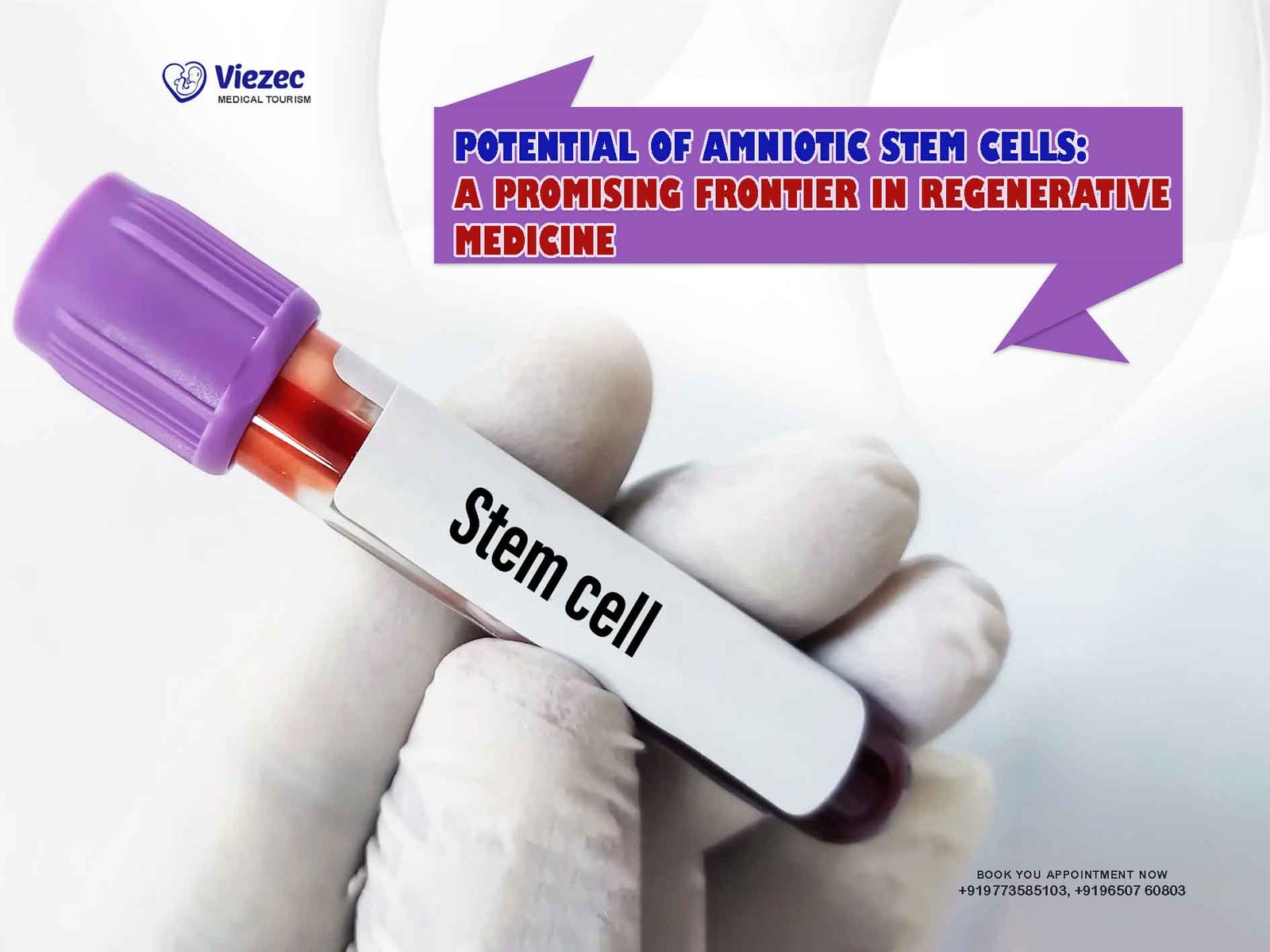 Amniotic Stem Cells