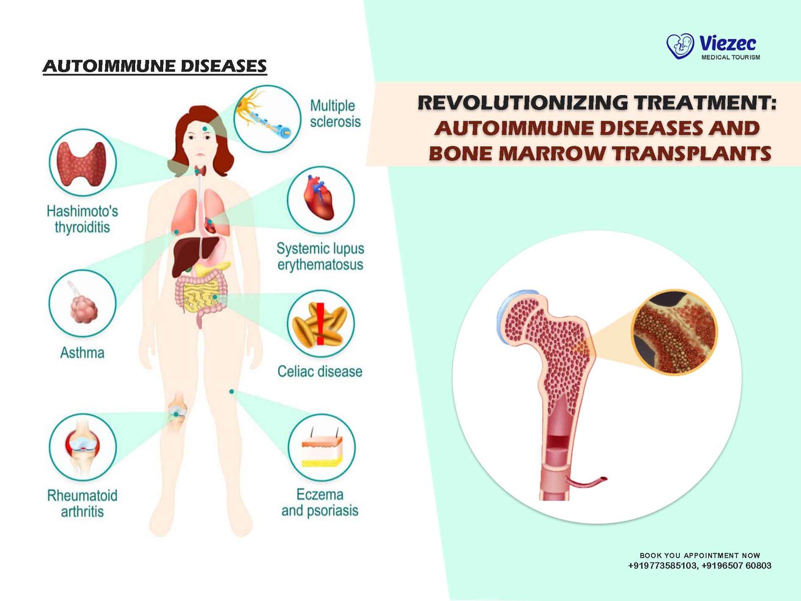 Autoimmune Diseases