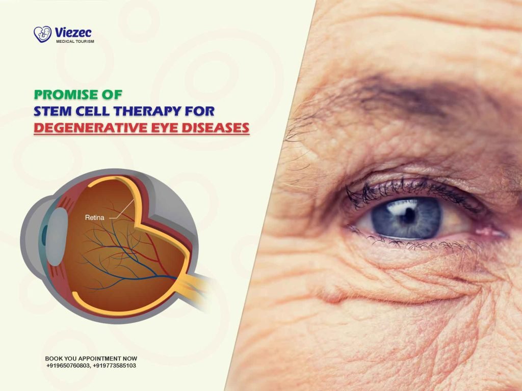 Promise of Stem Cell Therapy for Degenerative Eye Diseases