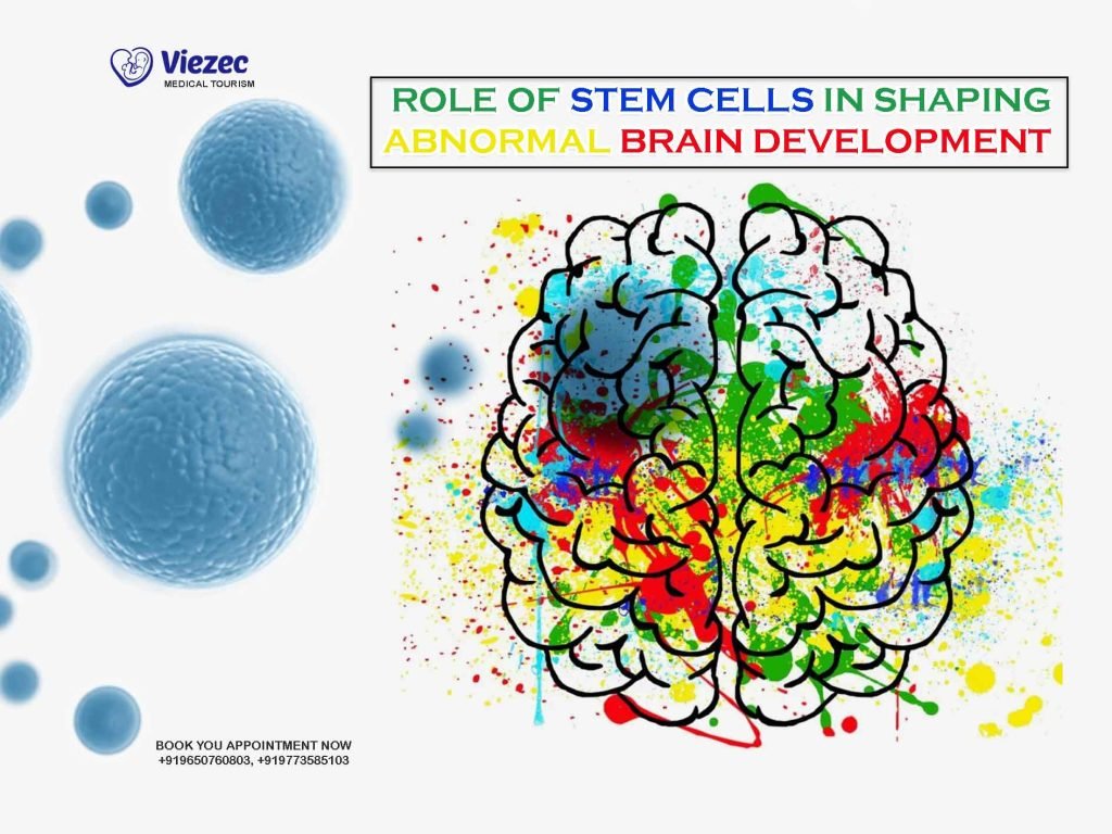 role of stem cell in abnormal brain development