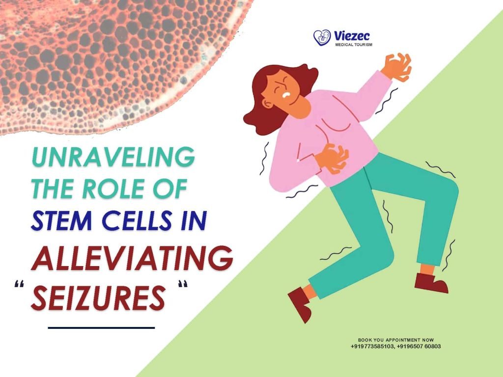 Unraveling the Role of Stem Cells in Alleviating Seizures