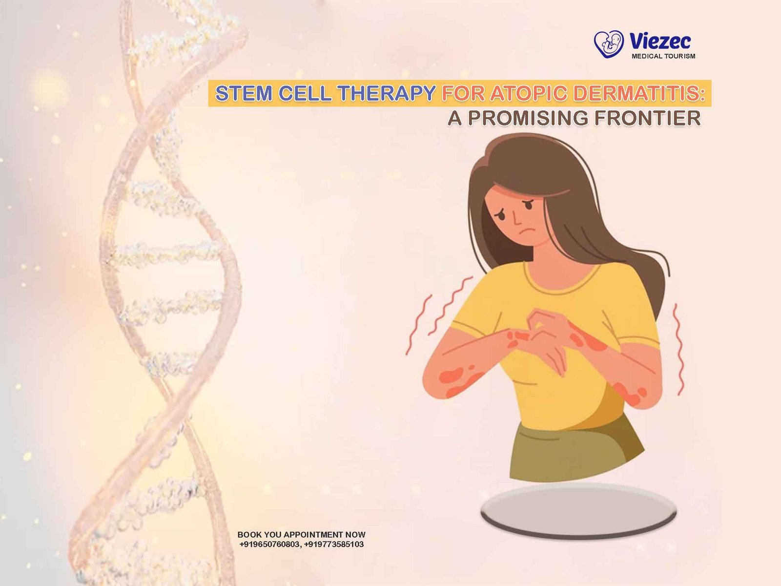Stem Cell Therapy for Atopic Dermatitis: A Promising Frontier