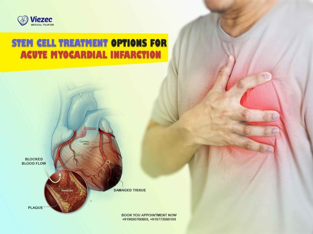 Stem Cell Treatment Options for Acute Myocardial Infarction