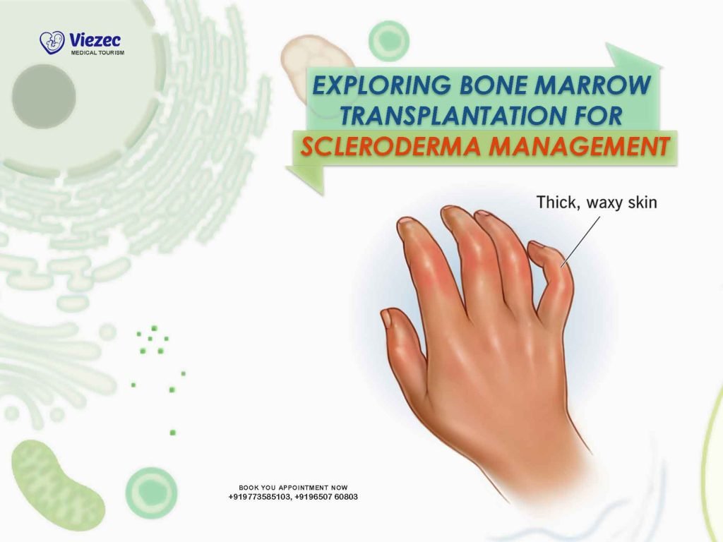 bone marrow transplant for scleroderma