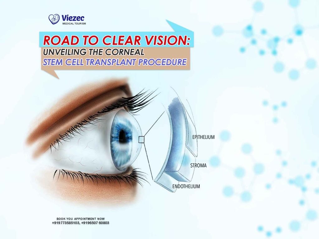 corneal stem cell transplant procedure