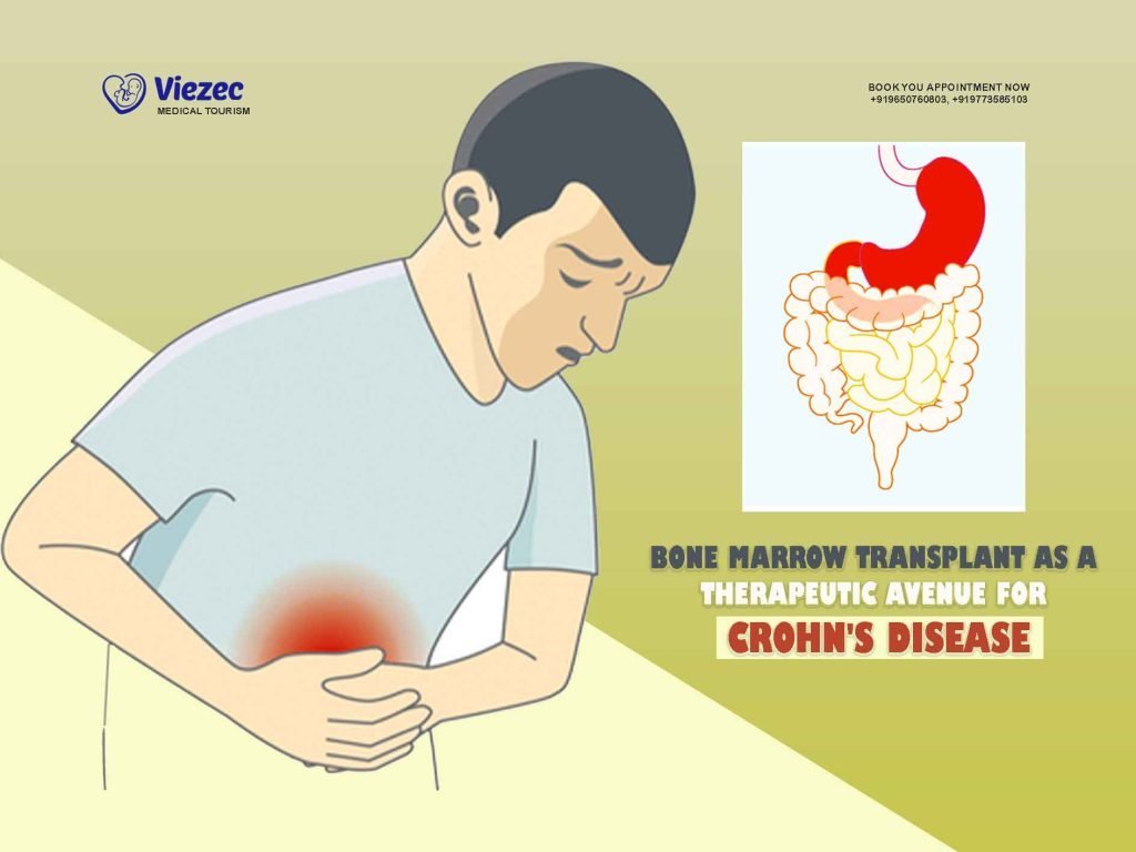 Bone Marrow Transplant as a Therapeutic Avenue for Crohn's Disease