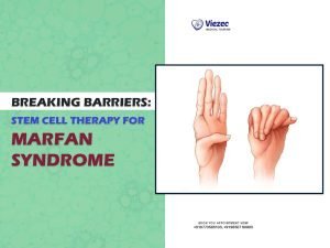 Breaking Barriers: Stem Cell Therapy for Marfan Syndrome