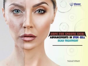 stem cell scar treatment