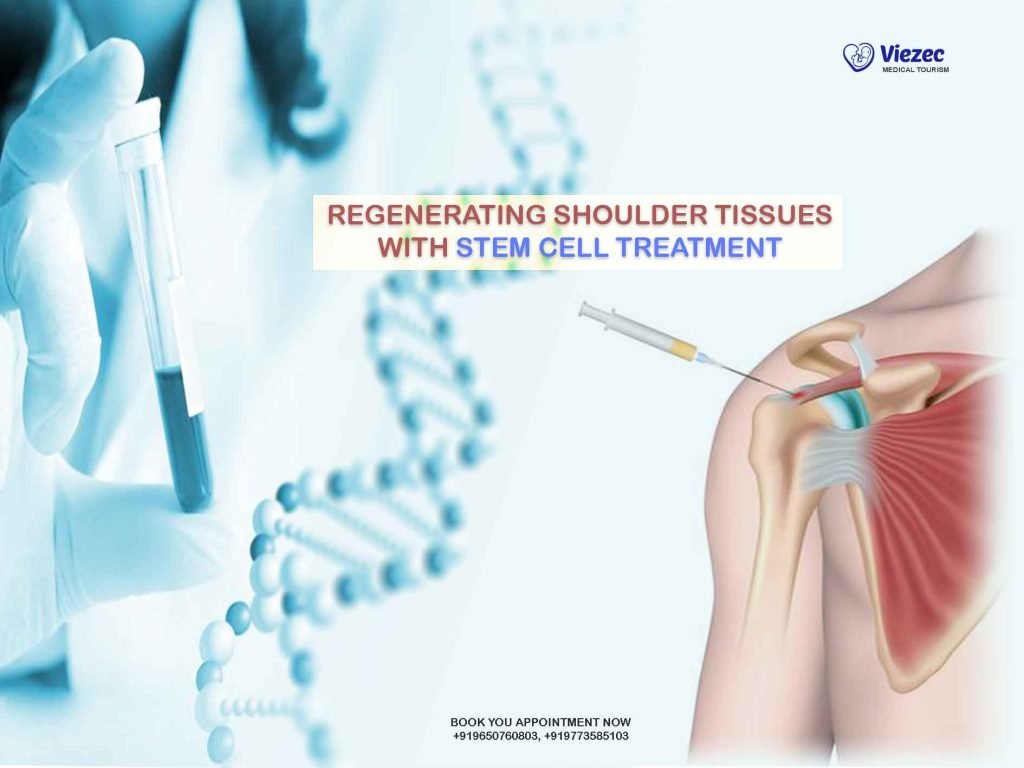 shoulder stem cell treatment