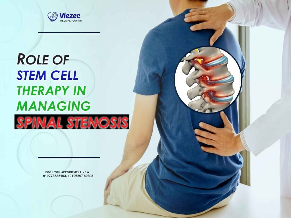stem cell therapy spinal stenosis
